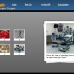 Aortic Aneurysm Surgery 00008